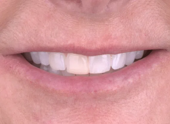 smile makeover dentist