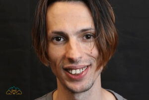 smile makeover giveaway - sam's story - colorado springs co
