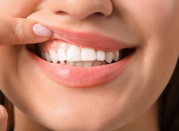 Do You Have Healthy Gums?