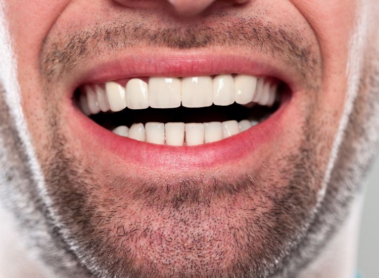 How Single Dental Implants Work