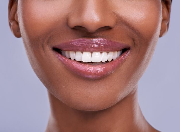 Teeth Whitening: What Are Your Options?