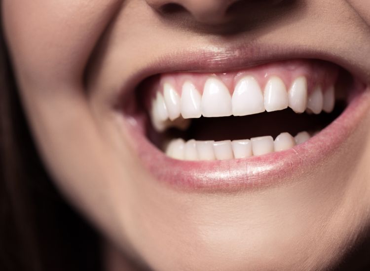 The Benefits of Invisalign