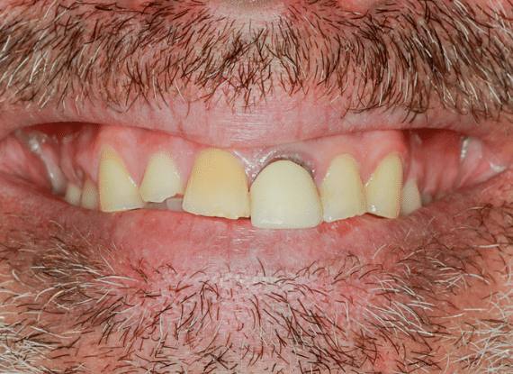smile-gallery-kissing-camels-10-1-opt